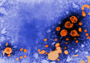 Microscope image of Hepatitis B virus